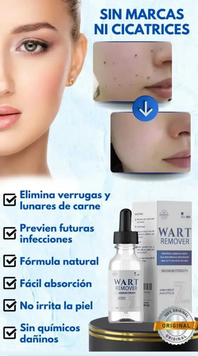 Wart Remover™ Elimina verrugas sin dolor desde casa