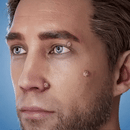 FormuClear™ - Elimina verrugas sin dolor y seguro + ENVIO GRATIS